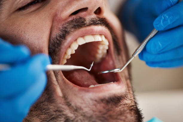 Best Emergency Dentist for Knocked-Out Tooth in Cochran, GA