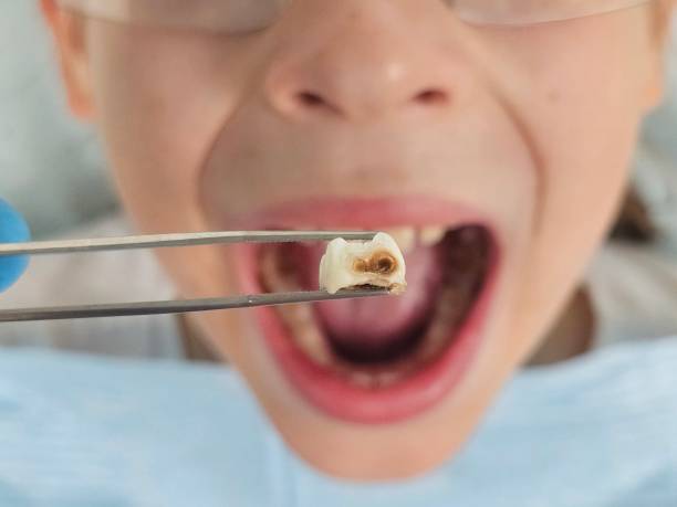 Best Orthodontic Emergency Dentist in Cochran, GA